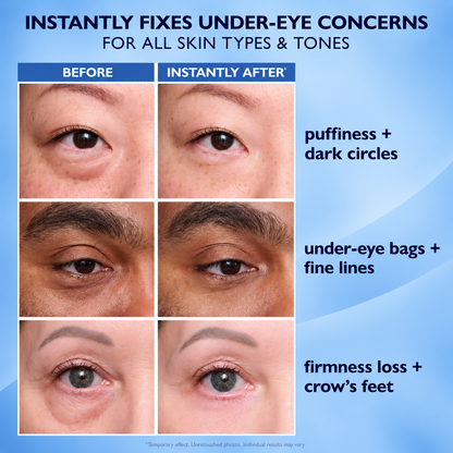 Alisanda™ Eye Tightener Easy.