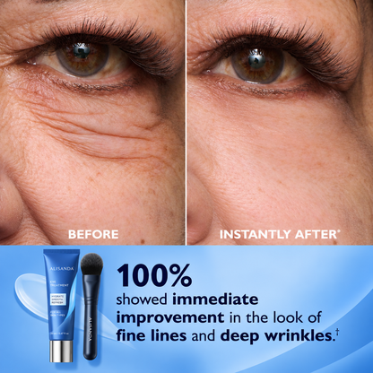 Alisanda™ Eye Tightener Easy.